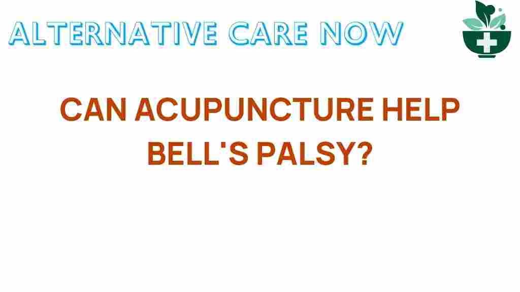 acupuncture-bells-palsy-relief