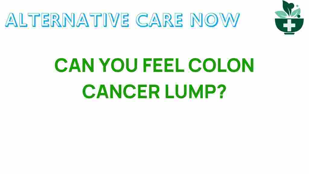 colon-cancer-lump-signs