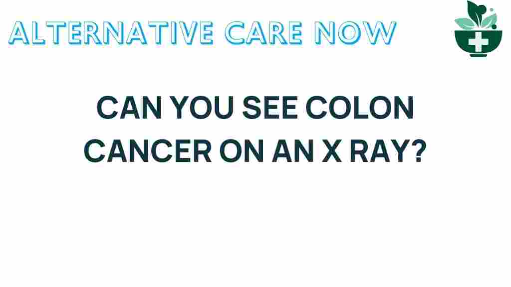 can-x-ray-reveal-colon-cancer