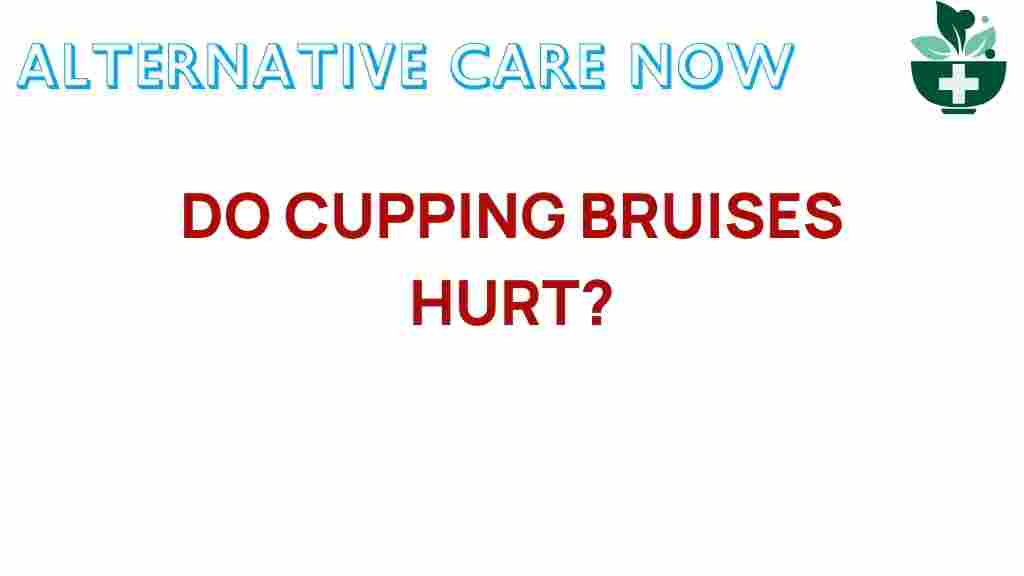 cupping-therapy-bruises-hurt