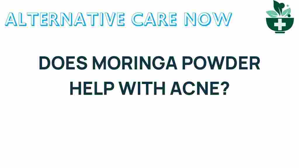 moringa-powder-acne
