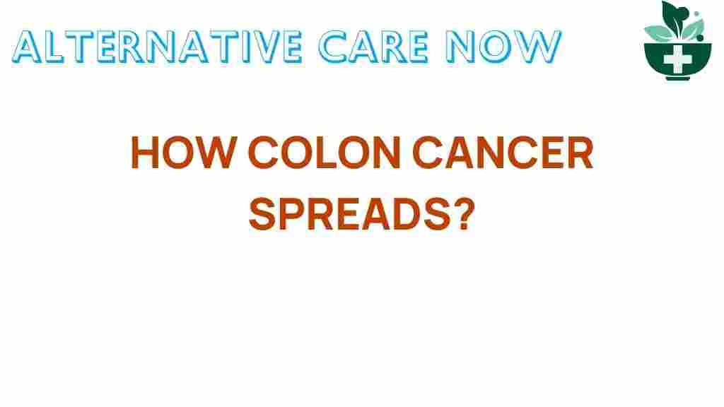 colon-cancer-spreads