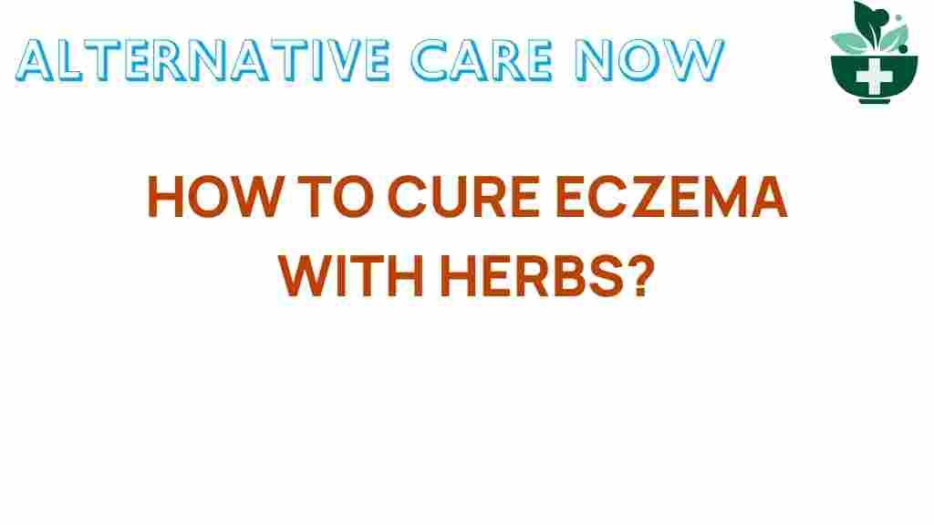 cure-eczema-with-herbs