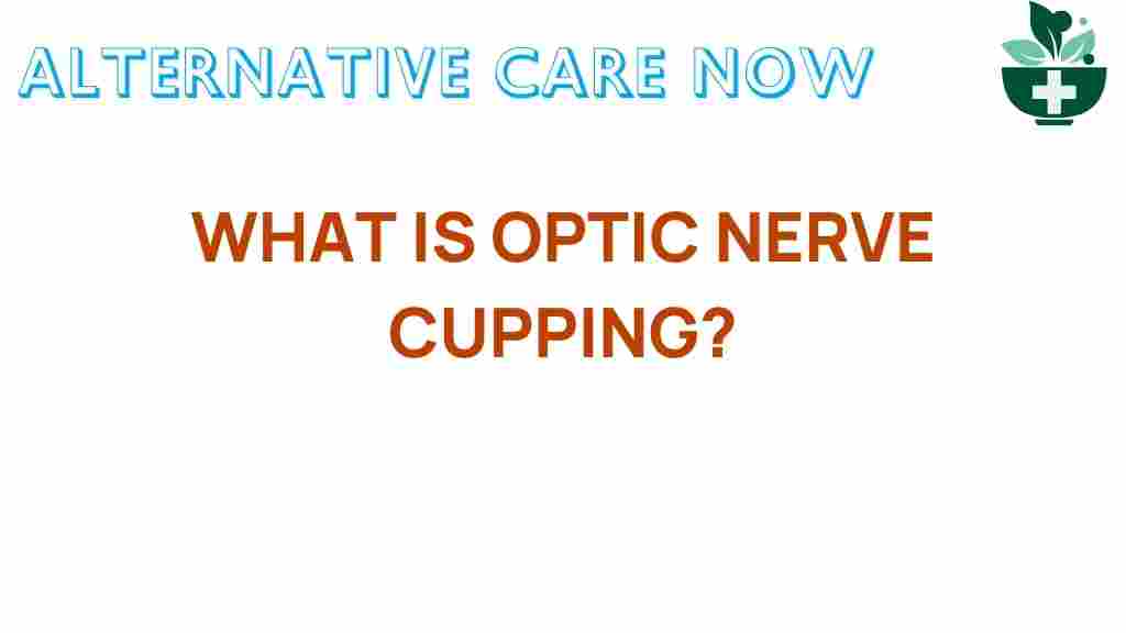 optic-nerve-cupping